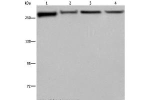 Western Blot analysis of PC3, Hela, NIH/3T3 and HUVEC cell using FLNA Polyclonal Antibody at dilution of 1:800 (Filamin A antibody)