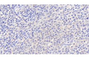 Detection of SRGN in Human Spleen Tissue using Polyclonal Antibody to Serglycin (SRGN) (SRGN antibody  (AA 28-158))