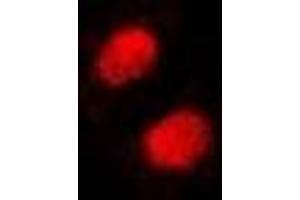 Immunofluorescent analysis of SSRP1 staining in Hela cells. (SSRP1 antibody)