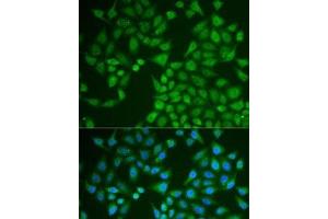 Immunofluorescence analysis of U2OS cells using PNLIP Polyclonal Antibody (PNLIP antibody)