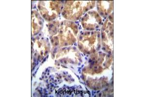 TRPM6(CHAK2) Antibody immunohistochemistry analysis in formalin fixed and paraffin embedded human kidney tissue followed by peroxidase conjugation of the secondary antibody and DAB staining. (TRPM6 antibody  (AA 317-348))