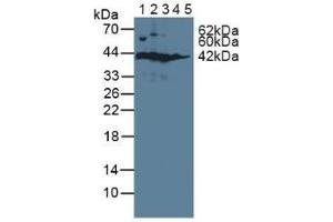 Figure. (SORD antibody  (AA 2-357))