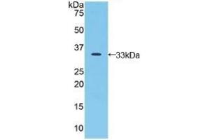 Detection of Recombinant JAG2, Human using Polyclonal Antibody to Jagged 2 Protein (JAG2) (JAG2 antibody  (AA 714-981))