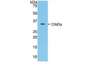 Detection of Recombinant JAG2, Human using Polyclonal Antibody to Jagged 2 Protein (JAG2)