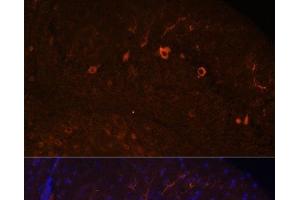 Immunofluorescence analysis of Mouse brain using KAL1 Polyclonal Antibody at dilution of 1:100. (KAL1 antibody)