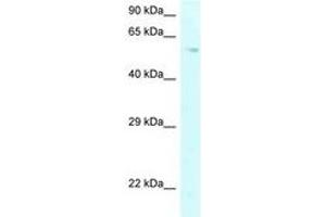 Image no. 1 for anti-Prolyl 4-Hydroxylase, alpha Polypeptide II (P4HA2) (AA 289-338) antibody (ABIN6747697)