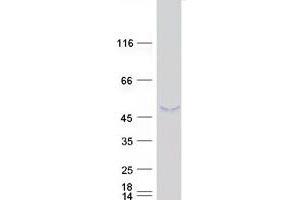 SUN3 Protein (Transcript Variant 2) (Myc-DYKDDDDK Tag)