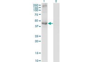 Western Blot analysis of TCN2 expression in transfected 293T cell line by TCN2 monoclonal antibody (M01), clone 2F4.