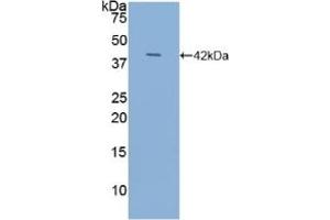 Detection of Recombinant NT-ProANP, Human using Polyclonal Antibody to N-Terminal Pro-Atrial Natriuretic Peptide (NT-ProANP) (PRO-ANP antibody  (AA 25-123))