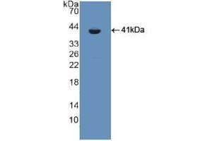 Detection of Recombinant CSPG5, Rat using Polyclonal Antibody to Chondroitin Sulfate Proteoglycan 5 (CSPG5) (CSPG5 antibody  (AA 139-370))