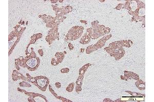 Image no. 1 for anti-Keratin 20 (KRT20) antibody (ABIN335316) (KRT20 antibody)