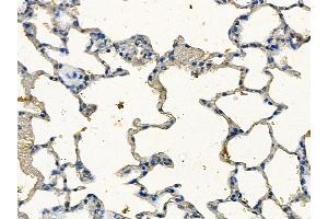 ABIN7094272 and ABIN7098319 at 1/100 staining rat lung tissue by IHC-P. (HEATR2 antibody  (Internal Region))