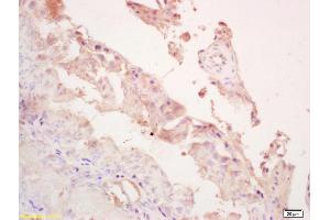 Formalin-fixed and paraffin embedded rat testis labeled with Rabbit Anti LOXL4 Polyclonal Antibody, Unconjugated (ABIN714791) at 1:200 followed by conjugation to the secondary antibody and DAB staining (LOXL4 antibody  (AA 101-200))