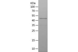 Western Blotting (WB) image for Solute Carrier Family 25, Member 13 (Citrin) (slc25a13) (AA 251-500) protein (His-IF2DI Tag) (ABIN7282921) (slc25a13 Protein (AA 251-500) (His-IF2DI Tag))