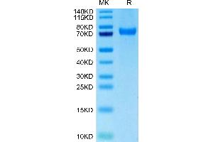 Biotinylated Human CD229 on Tris-Bis PAGE under reduced condition. (LY9 Protein (AA 48-454) (His-Avi Tag,Biotin))