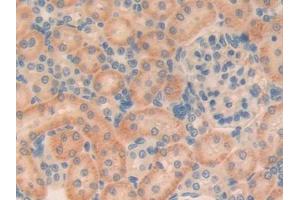 IHC-P analysis of Rat Kidney Tissue, with DAB staining. (TGFB1I1 antibody  (AA 256-461))