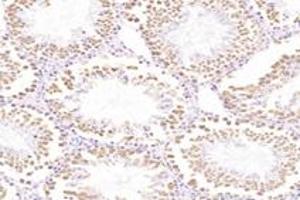 Immunohistochemistry analysis of paraffin-embedded rat testis using,TTC12 (ABIN7075869) at dilution of 1: 4400 (TTC12 antibody)