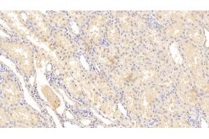 Detection of MMP2 in Human Kidney Tissue using Monoclonal Antibody to Matrix Metalloproteinase 2 (MMP2) (MMP2 antibody  (AA 110-660))
