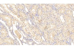 Detection of MMP2 in Human Kidney Tissue using Monoclonal Antibody to Matrix Metalloproteinase 2 (MMP2) (MMP2 antibody  (AA 110-660))