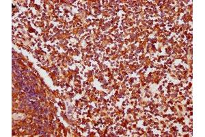 Immunohistochemistry (IHC) image for anti-Complement Component (3d/Epstein Barr Virus) Receptor 2 (CR2) (AA 761-964) antibody (ABIN7148413)