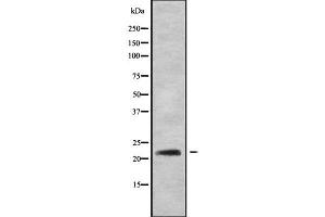 Western blot analysis of RAB22A using HT29 whole cell lysates