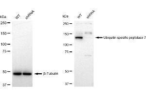 Western blotting analysis using Ubiquitin specific peptidase 7 antibody (ABIN7800738). (Recombinant USP7 antibody)