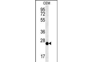CRISPLD2 Antibody (N-term) (ABIN651759 and ABIN2840390) western blot analysis in CEM cell line lysates (15 μg/lane). (CRISPLD2 antibody  (N-Term))