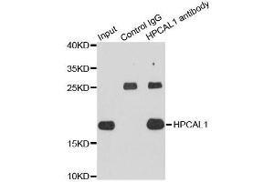 Immunoprecipitation analysis of extracts of HepG2 cells using HPCAL1 antibody. (HPCAL1 antibody  (AA 1-193))