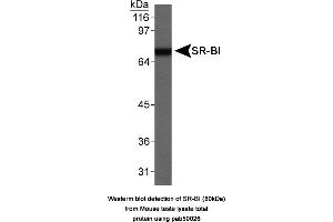 Image no. 1 for anti-Scavenger Receptor Class B, Member 1 (SCARB1) antibody (ABIN363335)