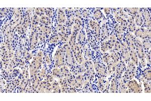 Immunohistochemistry (IHC) image for anti-Ribosomal Protein S6 Kinase, 70kDa, Polypeptide 1 (RPS6KB1) (AA 91-352) antibody (ABIN7430135)