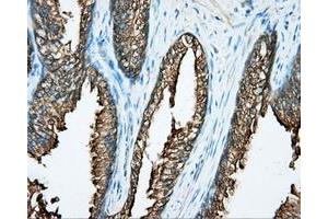 Immunohistochemical staining of paraffin-embedded prostate tissue using anti-DNTTIP1 mouse monoclonal antibody. (DNTTIP1 antibody)