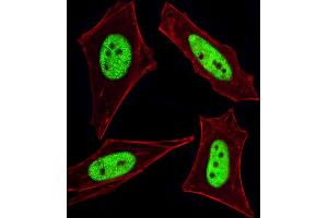 Fluorescent image of HeLa cells stained with Cellular Apoptosis Susceptibility Antibody (N-term) (ABIN1882070 and ABIN2838356).
