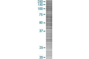 IFI30 transfected lysate. (IFI30 293T Cell Transient Overexpression Lysate(Denatured))