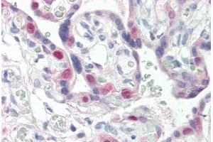 Human Placenta (formalin-fixed, paraffin-embedded) stained with CDK2 antibody ABIN337209 at 5 ug/ml followed by biotinylated anti-mouse IgG secondary antibody ABIN481714, alkaline phosphatase-streptavidin and chromogen. (CDK2 antibody)