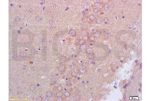 Formalin-fixed and paraffin embedded rat brain tissue labeled with Anti-GABRA1 Polyclonal Antibody, Unconjugated (ABIN673734) at 1:200 followed by conjugation to the secondary antibody and DAB staining (GABRA1 antibody  (AA 301-450))