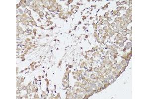 Immunohistochemistry of paraffin-embedded Rat testis using OPRK1 Polyclonal Antibody at dilution of 1:100 (40x lens). (OPRK1 antibody)