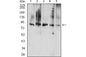 Western Blotting (WB) image for anti-Colony Stimulating Factor 3 Receptor (Granulocyte) (CSF3R) (AA 25-187) antibody (ABIN5611136)