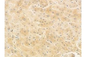 ABIN6256534 and ABIN6267057 at 1/100 staining human normal liver tissue by IHC-P.