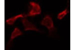 ABIN6273998 staining HepG2 by IF/ICC. (Caspase 2 antibody  (Internal Region))