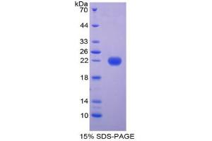 SDS-PAGE analysis of Cow FTL Protein. (Ferritin, Light Polypeptide (FTL) Peptide)