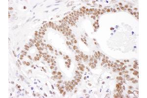 anti-Poly A Binding Protein Nuclear 1 (PABPN1) (AA 100-150) antibody