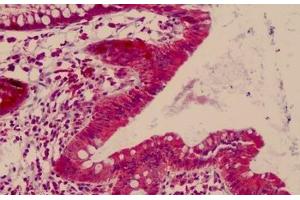 Human, Small Intestine: Formalin-Fixed Paraffin-Embedded (FFPE) (CDK2AP1 antibody  (AA 51-100))