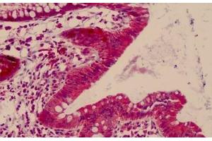 Human, Small Intestine: Formalin-Fixed Paraffin-Embedded (FFPE)