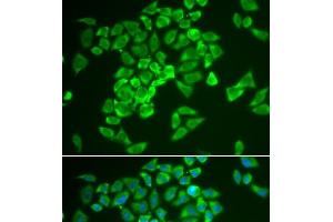 Immunofluorescence analysis of A549 cells using KEAP1 Polyclonal Antibody (KEAP1 antibody)