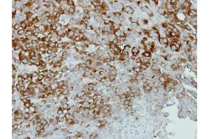 Immunohistochemistry (IHC) image for anti-Actinin, alpha 4 (ACTN4) (C-Term) antibody (ABIN2855119)
