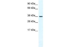 WB Suggested Anti-TRPM3 Antibody Titration:  1.