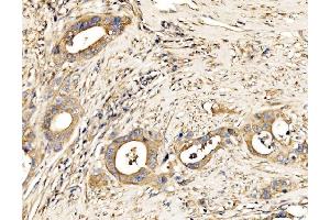 IHC analysis of MLX-interacting protein/MLXIP using anti-MLX-interacting protein/MLXIP antibody (ABIN7602593). (MLXIP antibody  (AA 88-348))
