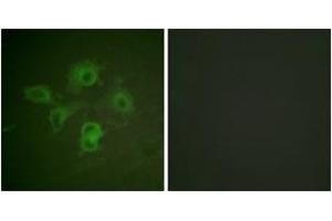 Immunofluorescence analysis of HuvEc cells, using EPHB1/2 (Phospho-Tyr594/604) Antibody. (EPHB1/2 antibody  (pTyr594))