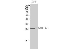 Western Blotting (WB) image for anti-C/EBP delta/epsilon (C-Term) antibody (ABIN3174089) (C/EBP delta/epsilon (C-Term) antibody)