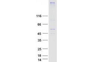 Validation with Western Blot